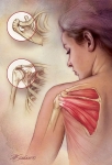 Rotator Cuff Rotator Cuff