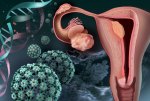 GYN-Cancers