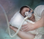 Continuous Positive Airway Pressure (CPAP)