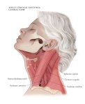 Cervical-Dystonia Cervical-Dystonia