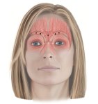 Glabellar-Line-Injection-Sites Glabellar-Line-Injection-Sites