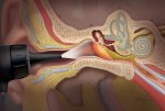 Otology Otology