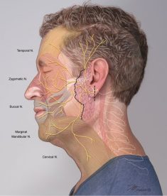 1_Facial-Nerve-Injury