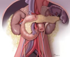 Retroperitoneal Structures