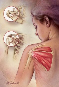 Rotator Cuff