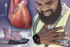 Cardiovascular Disease Signs and Syptoms