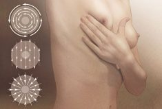 Patterns for Self Breast Exam